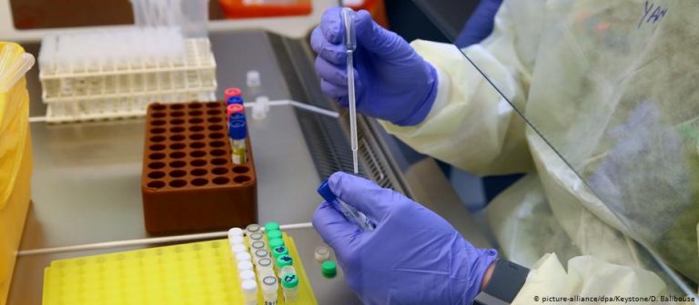 1 i vdekur dhe 21 pozitiv me KOVID-19 sot në Kumanovë