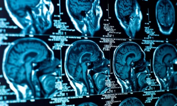 Një sëmundje e mistershme po i prek gjithmonë e më shumë të rinjtë