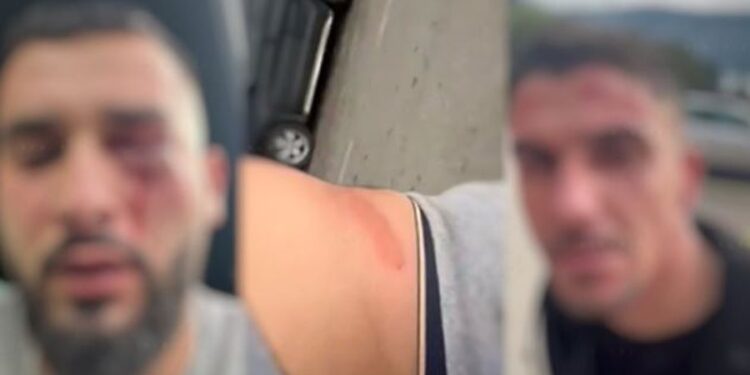 Tre shqiptarët e dhunuar në Malin e Zi rikthehen në atdhe