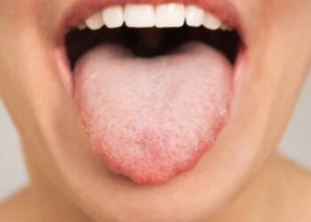 Nëse gjuha juaj duket kështu, nuk duhet të pini kafe