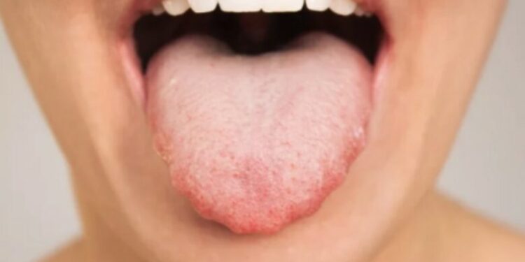 Nëse gjuha juaj duket kështu, nuk duhet të pini kafe