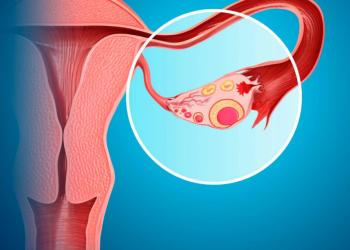 Shkencëtarët britanik po zhvillojnë vaksinën e parë kundër kancerit të vezoreve?