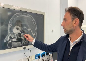 Kirurgu britanik largon tumoret e mëdha në tru përmes vetullave të pacientëve