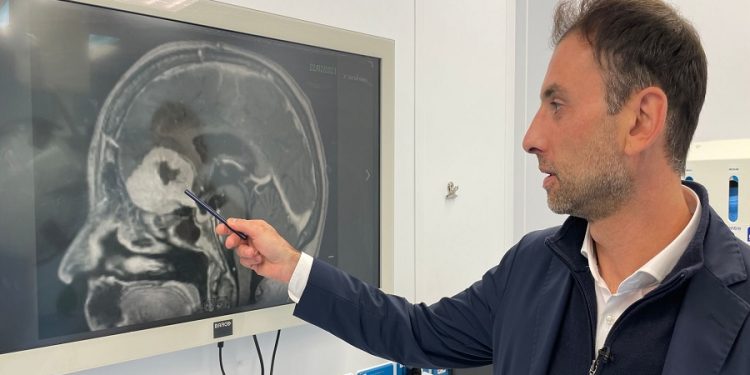 Kirurgu britanik largon tumoret e mëdha në tru përmes vetullave të pacientëve