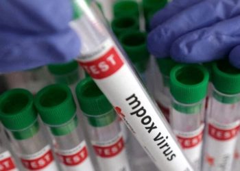 Konfirmohet rasti i parë me linë e majmunëve në Kosovë! Ja simptomat e virusit