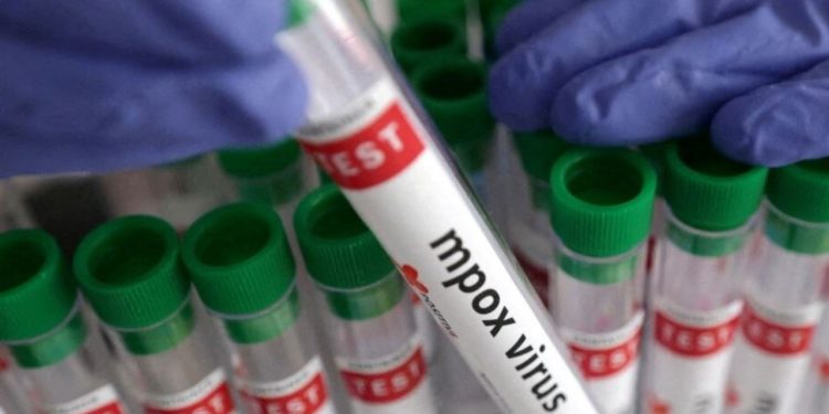 Konfirmohet rasti i parë me linë e majmunëve në Kosovë! Ja simptomat e virusit