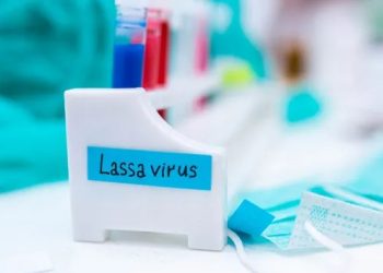 “E tmerrshme, kurrë nuk e kam parë kaq keq”/ Si reagoi Princi William kur mësoi se babai dhe gruaja e tij kishin kancer?