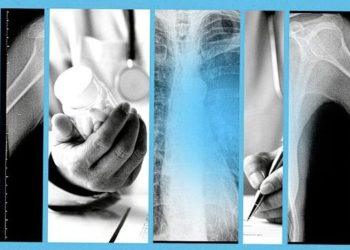 Zbulohet ilaçi i ri kundër kancerit që dyfishon mbijetesën