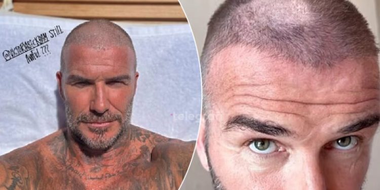 David Beckham përpiqet të mbulojë një “katastrofë flokësh” pas një prerjeje që i la një njollë tullace në mes të kokës