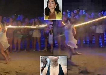 Argëtimi shkon keq, britanikja pëson djegie të rënda pasi litari me zjarr i lidhet në qafë