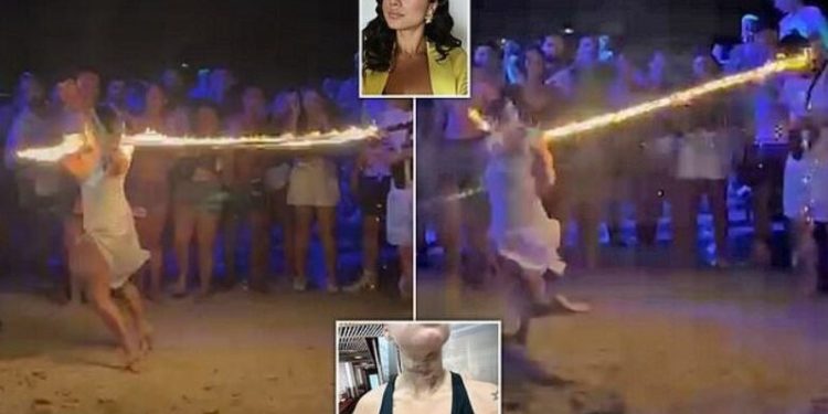 Argëtimi shkon keq, britanikja pëson djegie të rënda pasi litari me zjarr i lidhet në qafë