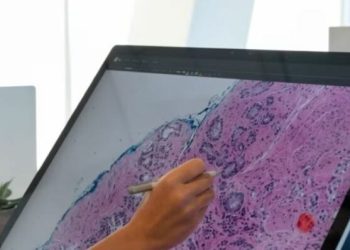 Mbretëria e Bashkuar në alarm/ Ja parashikimi i rasteve të reja me kancer, deri në vitin 2040