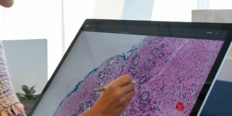 Mbretëria e Bashkuar në alarm/ Ja parashikimi i rasteve të reja me kancer, deri në vitin 2040