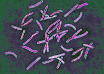 Mjekët në Britani paralajmërojnë: Tuberkulozi, “infeksioni më vdekjeprurës në botë”, po rritet ndjeshëm