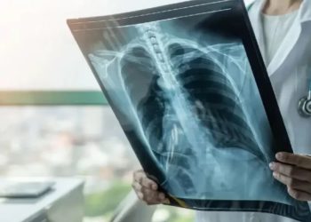 OBSH ngre alarmin: Tuberkulozi, sëmundja infektive më vdekjeprurëse në botë, shkaktoi 1.2 milion vdekje vetëm në vitin 2024 