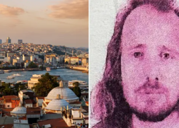 Bëri transplant të flokëve dhe trajtim dentar, humb jetën në Turqi, shqiptaro-britaniku