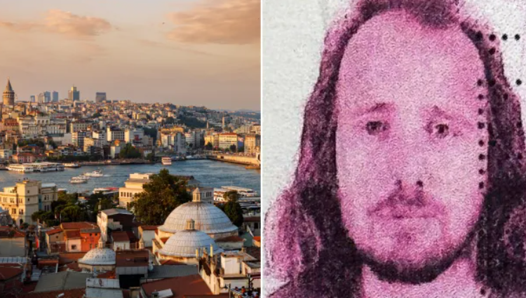 Bëri transplant të flokëve dhe trajtim dentar, humb jetën në Turqi, shqiptaro-britaniku