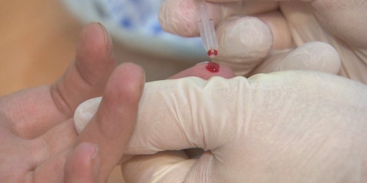 Dita Botërore e AIDS, ISHP: 125 raste të reja në Shqipëri gjatë vitit 2025, apel për parandalim